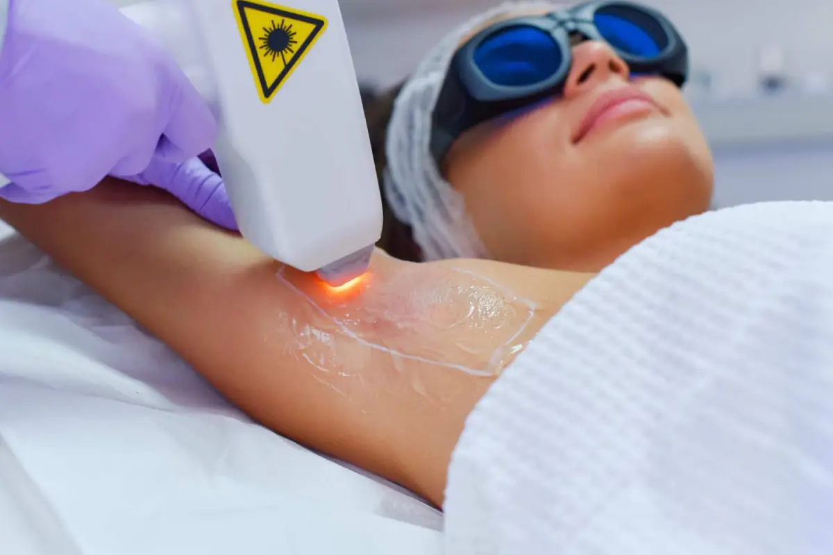 VLCC Laser Hair Removal treatment setup at Chrompet center – modern clinic environment with advanced laser equipment for permanent hair reduction"