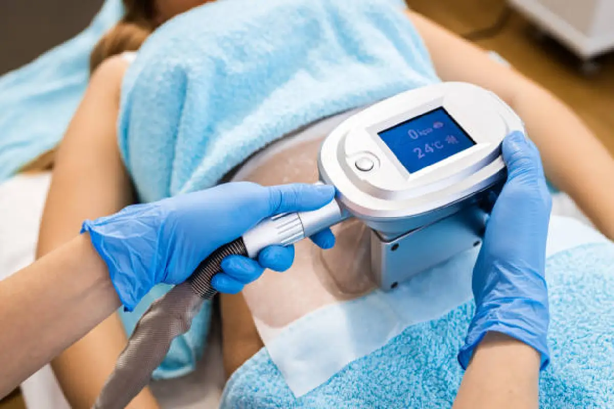 "CoolSculpting treatment in progress at VLCC Chrompet – non-invasive fat reduction procedure"